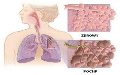 Wereld COPD-Dag